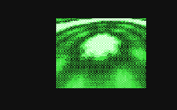 32zc.gif (3229 byte)